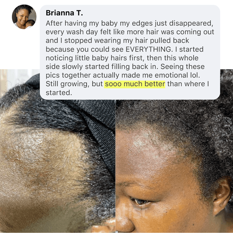 Postpartum shedding