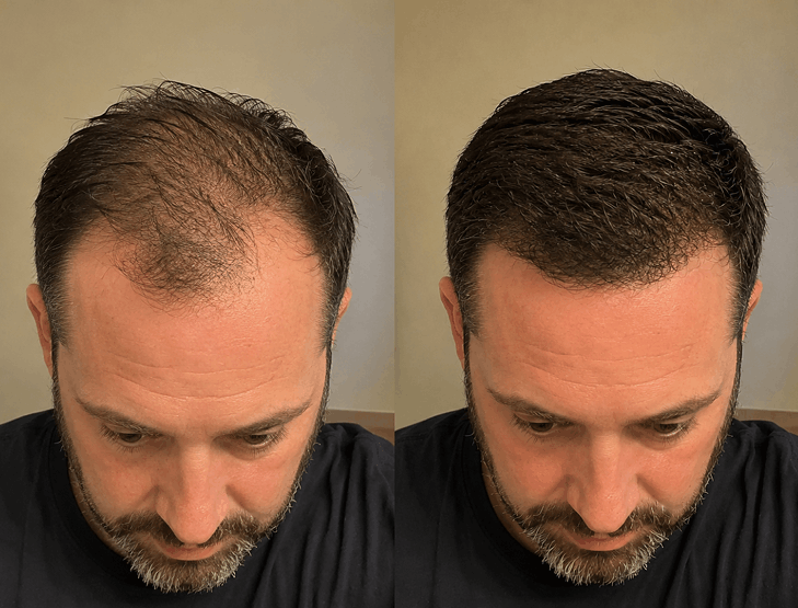 Finally, real regrowth